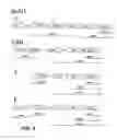 Fig. 06 - NOVEL PROTEINS WITHIN THE TYPE E BOTULINUM NEUROTOXIN COMPLEX