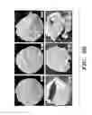 Fig. 07 - Electrospun silk material systems for wound healing