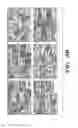 Fig. 11 - Electrospun silk material systems for wound healing