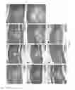 Fig. 13 - SILK FIBROIN HYDROGELS AND USES THEREOF