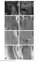 Fig. 14 - SILK FIBROIN HYDROGELS AND USES THEREOF