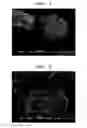 Fig. 02 - RAPIDLY DISINTEGRATING SOLID PREPARATION