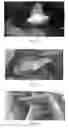Fig. 08 - USE OF PHARMACEUTICAL COMPOSITIONS IN PREPARING PHARMACEUTICALS FOR TREATING DIABETIC ULCER