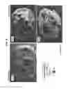 Fig. 06 - Amorphous Protein Extrudates