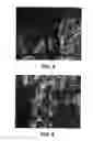 Fig. 04 - SILICON CARBIDE BODY AND METHOD OF FORMING SAME