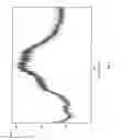 Fig. 03 - NOVEL POLYMORPHIC FORM OF TERIFLUNOMIDE SALTS