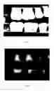 Fig. 06 - Image analysis method