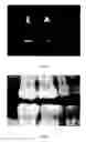 Fig. 07 - Image analysis method