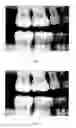 Fig. 08 - Image analysis method