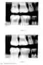 Fig. 09 - Image analysis method