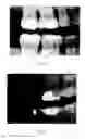 Fig. 10 - Image analysis method
