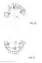 Fig. 04 - Dental bridge attachment system and method