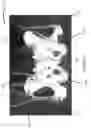 Fig. 05 - Pressure Ulcer Simulator and Related Methods