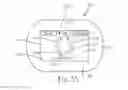 Fig. 31 - Personal care systems, products, and methods