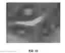 Fig. 08 - Enhanced deposition of chromogens