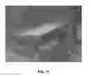 Fig. 09 - Enhanced deposition of chromogens