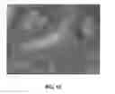 Fig. 10 - Enhanced deposition of chromogens