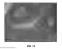 Fig. 11 - Enhanced deposition of chromogens