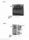 Fig. 05 - CHK2 polymorphism as a cancer marker