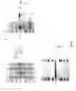 Fig. 43 - INFLAMMATORY BOWEL DISEASE PROGNOSTICS