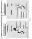 Fig. 45 - INFLAMMATORY BOWEL DISEASE PROGNOSTICS