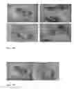 Fig. 03 - Spontaneously contracting fish cell aggregates, use thereof and method for the production thereof