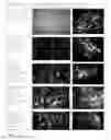 Fig. 04 - Spontaneously contracting fish cell aggregates, use thereof and method for the production thereof