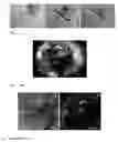 Fig. 09 - Spontaneously contracting fish cell aggregates, use thereof and method for the production thereof