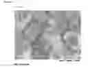 Fig. 03 - Antibodies for the detection of integrin complexes in FFPE material