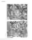Fig. 13 - Antibodies for the detection of integrin complexes in FFPE material