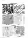 Fig. 25 - Antibodies for the detection of integrin complexes in FFPE material