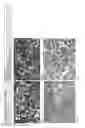 Fig. 31 - Antibodies for the detection of integrin complexes in FFPE material