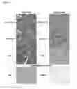 Fig. 32 - Antibodies for the detection of integrin complexes in FFPE material