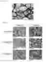 Fig. 35 - Antibodies for the detection of integrin complexes in FFPE material