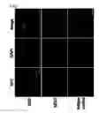Fig. 03 - Medium composition comprising neuropeptide Y for the generation, maintenance, prolonged undifferentiated growth of pluripotent stem cells and method of culturing pluripotent stem cell using the same