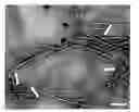 Fig. 01 - COLLAGEN-BASED MATRICES FOR VESSEL DENSITY AND SIZE REGULATION
