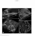 Fig. 16 - COLLAGEN-BASED MATRICES FOR VESSEL DENSITY AND SIZE REGULATION