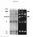 Fig. 31 - COLLAGEN-BASED MATRICES FOR VESSEL DENSITY AND SIZE REGULATION