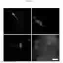 Fig. 49 - COLLAGEN-BASED MATRICES FOR VESSEL DENSITY AND SIZE REGULATION