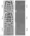 Fig. 10 - Method of detection using antibodies that specifically bind hedgehog-derived polypeptides