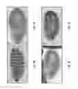 Fig. 13 - Method of detection using antibodies that specifically bind hedgehog-derived polypeptides