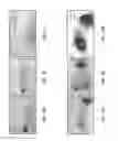 Fig. 22 - Method of detection using antibodies that specifically bind hedgehog-derived polypeptides