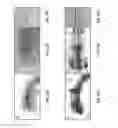 Fig. 23 - Method of detection using antibodies that specifically bind hedgehog-derived polypeptides