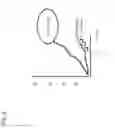 Fig. 03 - Method for measuring glycoprotein, method for examining liver disease, reagent for quantitative determination of glycoprotein, and glycan-marker glycoprotein as an index for clinical conditions of liver disease