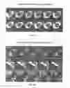 Fig. 13 - ISOZYME-SPECIFIC ANTAGONISTS OF PROTEIN KINASE C