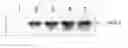 Fig. 01 - Pharmaceutical compositions comprising angiotensin-(1-9), derivatives thereof, or a vector expressing ACE2, useful for treating cardiovascular, pulmonary, cerebral, and/or renal remodeling