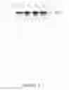 Fig. 02 - Pharmaceutical compositions comprising angiotensin-(1-9), derivatives thereof, or a vector expressing ACE2, useful for treating cardiovascular, pulmonary, cerebral, and/or renal remodeling