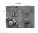 Fig. 11 - TREATMENT OF PROLIFERATIVE DISEASES