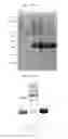 Fig. 05 - Cloning, yeast expression, purification and biological activity of the extension region of the soybean 7S globulin alfa' subunit involved in HEP G2 cell cholesterol homeostasis