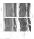 Fig. 12 - SILK FIBROIN HYDROGELS AND USES THEREOF
